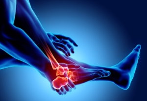 Recognizing Symptoms of Osteoarthritis in the Ankle