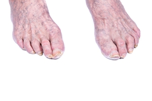 Understanding Changes in Elderly Feet