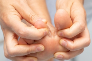Athlete's Foot and How It Affects Skin Health