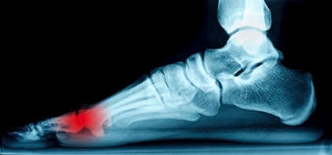 The Function of the Sesamoid Bones
