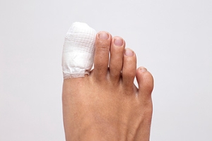 Handle With Care: What to Do if You Break Your Toe