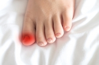 Symptoms of an Ingrown Toenail