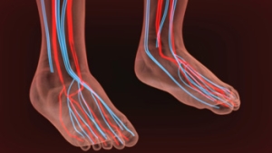 Ankle X-Ray is Negative